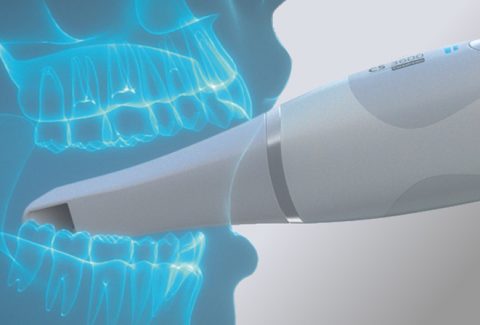 Schieritz Dental-Technik – Carestream Dental Scanner